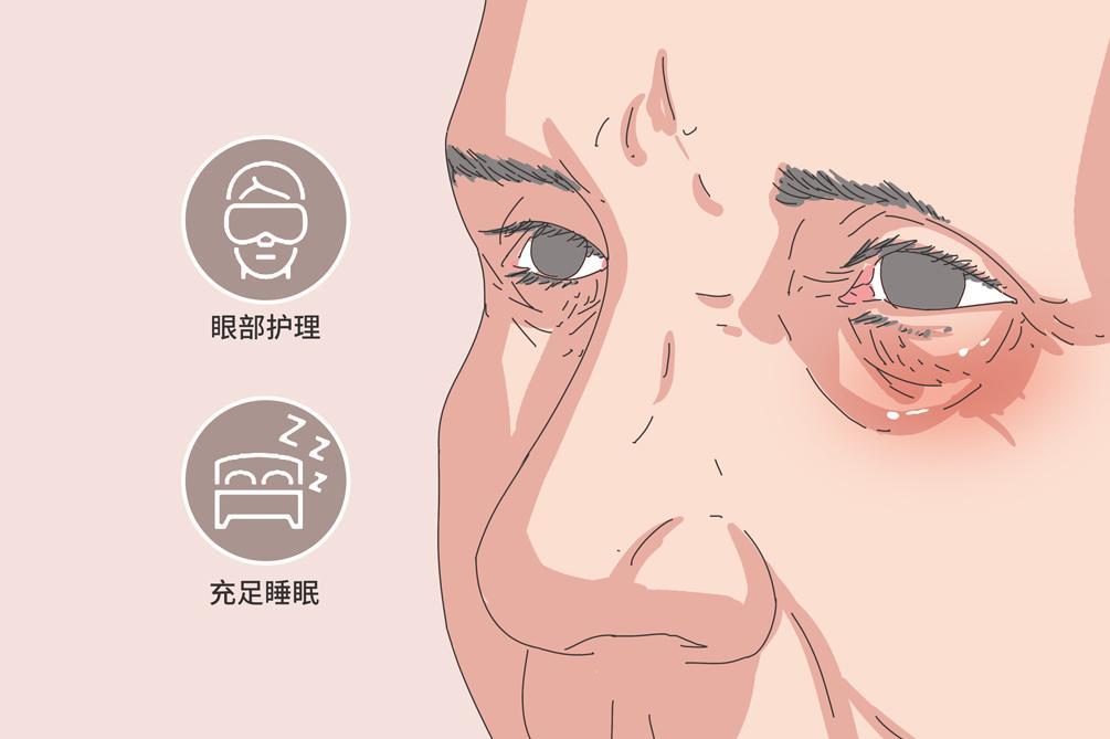 33岁深圳男士害怕留疤做了不开刀眼袋手术，术后效果怎么样？